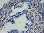 ERBB2 Antibody in Immunohistochemistry (Paraffin) (IHC (P))
