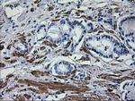 ERBB2 Antibody in Immunohistochemistry (Paraffin) (IHC (P))