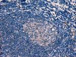 ERBB2 Antibody in Immunohistochemistry (Paraffin) (IHC (P))