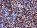 ERBB2 Antibody in Immunohistochemistry (Paraffin) (IHC (P))