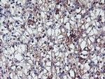 ERBB2 Antibody in Immunohistochemistry (Paraffin) (IHC (P))