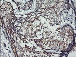 ERBB2 Antibody in Immunohistochemistry (Paraffin) (IHC (P))
