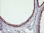 ERBB2 Antibody in Immunohistochemistry (Paraffin) (IHC (P))