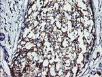 ERBB2 Antibody in Immunohistochemistry (Paraffin) (IHC (P))