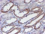 ERBB2 Antibody in Immunohistochemistry (Paraffin) (IHC (P))