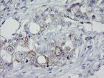 ERBB2 Antibody in Immunohistochemistry (Paraffin) (IHC (P))