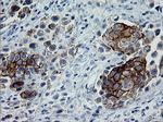 ERBB2 Antibody in Immunohistochemistry (Paraffin) (IHC (P))
