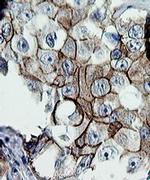 ERBB2 Antibody in Immunohistochemistry (Paraffin) (IHC (P))