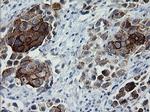 ERBB2 Antibody in Immunohistochemistry (Paraffin) (IHC (P))