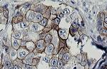 ERBB2 Antibody in Immunohistochemistry (Paraffin) (IHC (P))