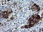ERBB2 Antibody in Immunohistochemistry (Paraffin) (IHC (P))
