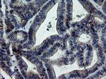 ERBB2 Antibody in Immunohistochemistry (Paraffin) (IHC (P))
