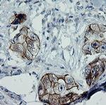 ERBB2 Antibody in Immunohistochemistry (Paraffin) (IHC (P))