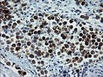 ERBB2 Antibody in Immunohistochemistry (Paraffin) (IHC (P))