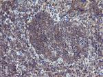 ERBB2 Antibody in Immunohistochemistry (Paraffin) (IHC (P))