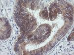 ERBB2 Antibody in Immunohistochemistry (Paraffin) (IHC (P))