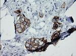 ERBB2 Antibody in Immunohistochemistry (Paraffin) (IHC (P))
