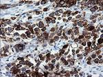 ERBB2 Antibody in Immunohistochemistry (Paraffin) (IHC (P))