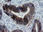 ERBB2 Antibody in Immunohistochemistry (Paraffin) (IHC (P))