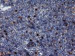 ERBB2 Antibody in Immunohistochemistry (Paraffin) (IHC (P))