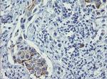 ERBB2 Antibody in Immunohistochemistry (Paraffin) (IHC (P))