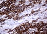 ERBB2 Antibody in Immunohistochemistry (Paraffin) (IHC (P))