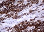 ERBB2 Antibody in Immunohistochemistry (Paraffin) (IHC (P))