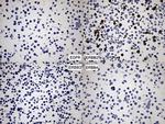 ERBB2 Antibody in Immunocytochemistry (ICC/IF)