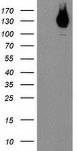 ERBB2 Antibody in Western Blot (WB)