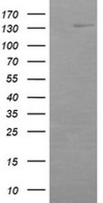 ERBB2 Antibody in Western Blot (WB)