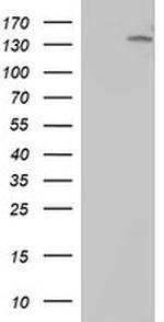 ERBB2 Antibody in Western Blot (WB)