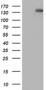 ERBB2 Antibody in Western Blot (WB)
