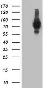 ERBB2 Antibody in Western Blot (WB)