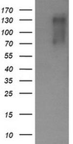 ERBB2 Antibody in Western Blot (WB)