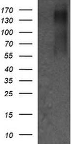 ERBB2 Antibody in Western Blot (WB)