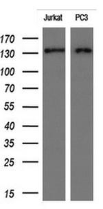 ERBB2 Antibody in Western Blot (WB)
