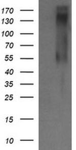 ERBB2 Antibody in Western Blot (WB)
