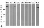 ERBB2 Antibody in Western Blot (WB)