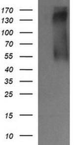 ERBB2 Antibody in Western Blot (WB)