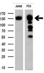 ERBB2 Antibody in Western Blot (WB)