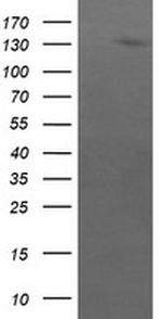 ERBB2 Antibody in Western Blot (WB)