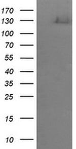 ERBB2 Antibody in Western Blot (WB)