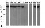 ERBB2 Antibody in Western Blot (WB)
