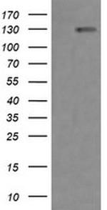 ERBB2 Antibody in Western Blot (WB)