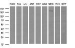 ERBB2 Antibody in Western Blot (WB)