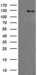 ERBB2 Antibody in Western Blot (WB)