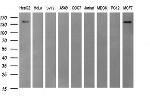 ERBB2 Antibody in Western Blot (WB)