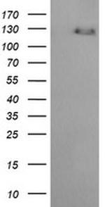 ERBB2 Antibody in Western Blot (WB)