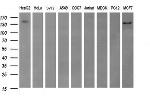 ERBB2 Antibody in Western Blot (WB)