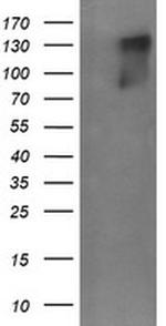ERBB2 Antibody in Western Blot (WB)